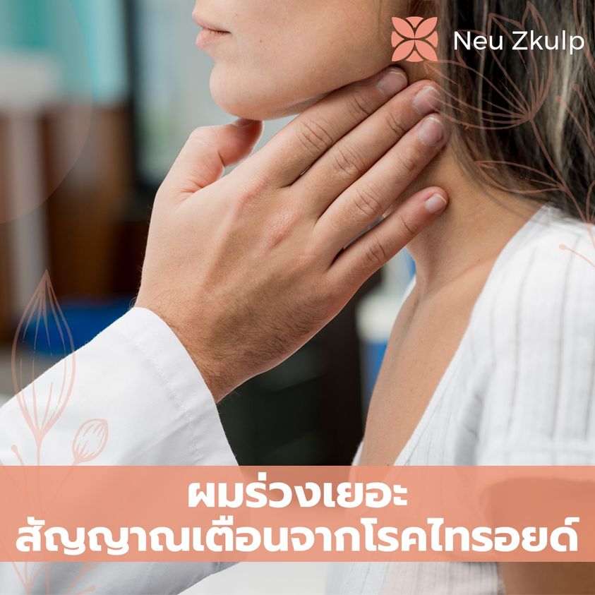 ดูแลสุขภาพเพื่อลดผมร่วง
