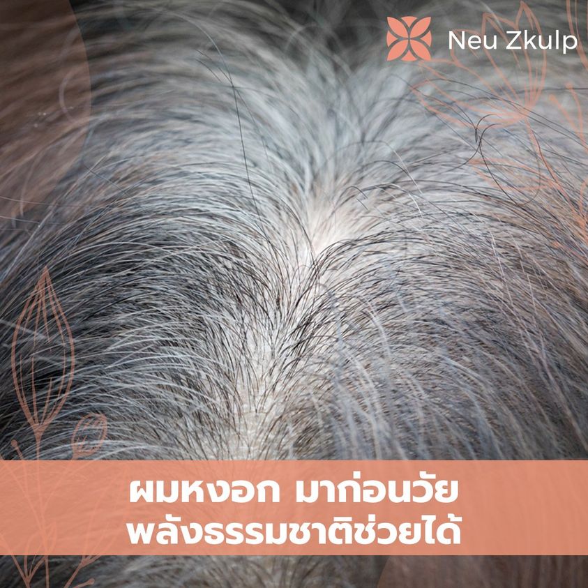 ผมหงอกมาก่อนวัย ธรรมชาติบำบัดช่วยได้