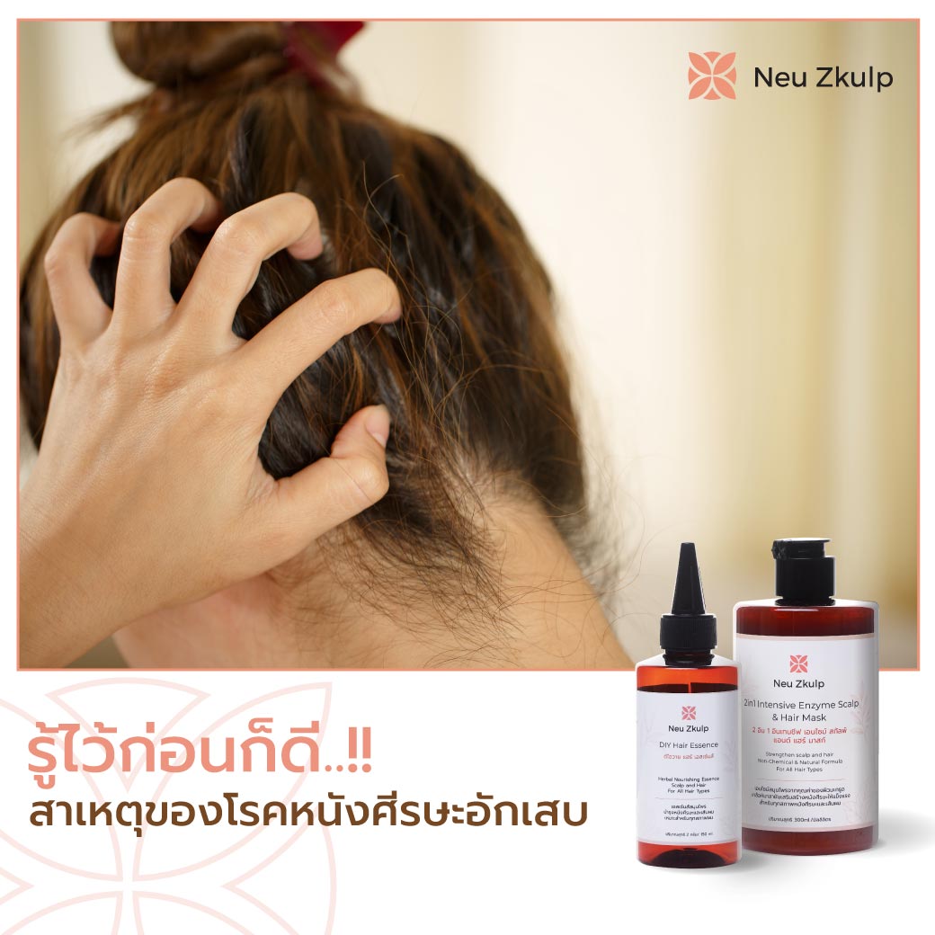 โรคหนังศีรษะอักเสบ